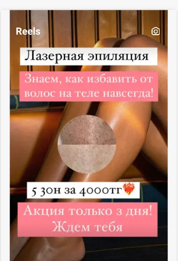 Реклама в Instagram: креативы, на которых реально строится результат — лазерная эпиляция